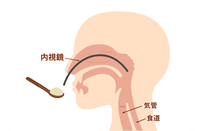 摂食嚥下リハビリテーション